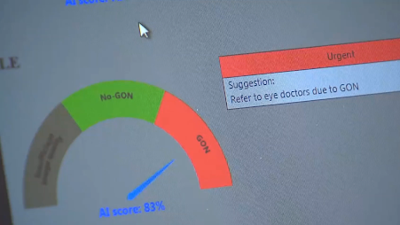 Platform showing AI results interface developed by Imsight.